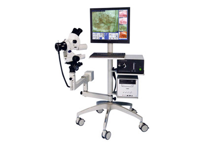 數(shù)碼電(diàn)子(zǐ)陰道(dào)鏡